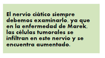 Nervio aciático